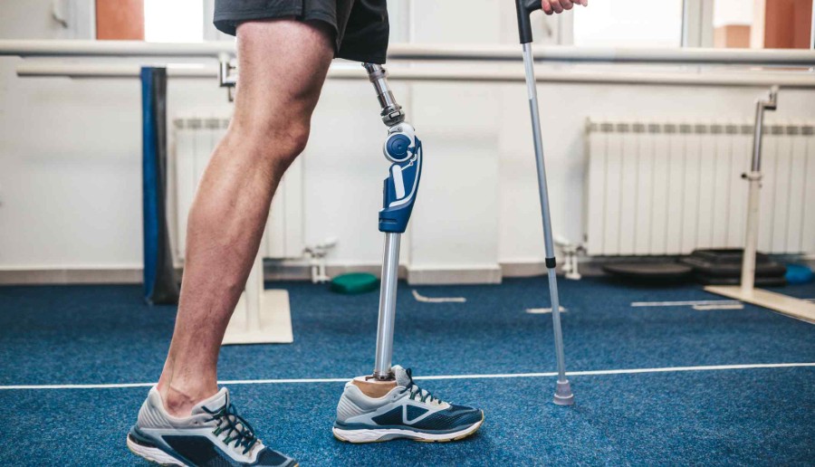 What Steps Should I Take Immediately After Suffering an Amputation Injury?