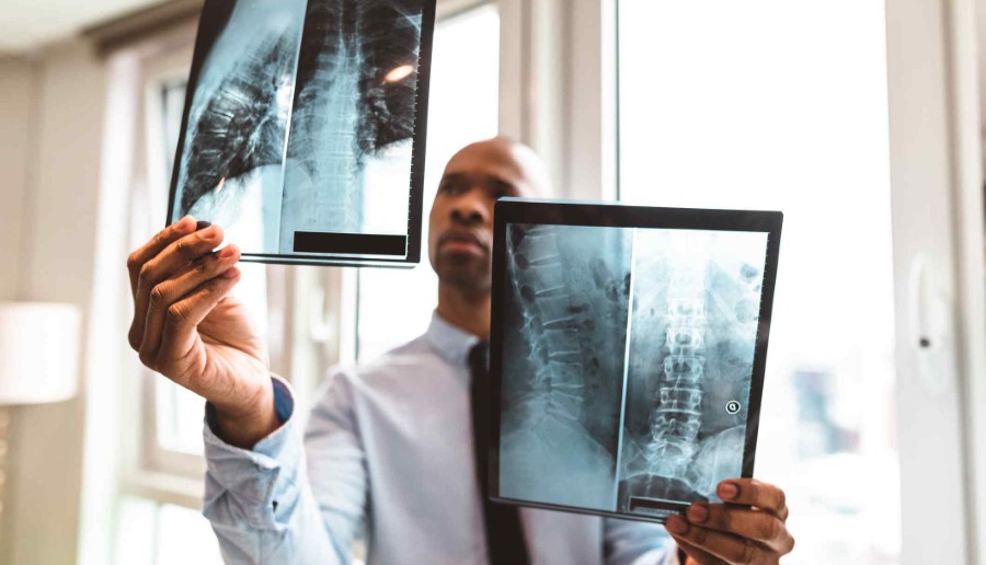 What Compensation Is Available for Spinal Cord Injury Victims in Spokane?